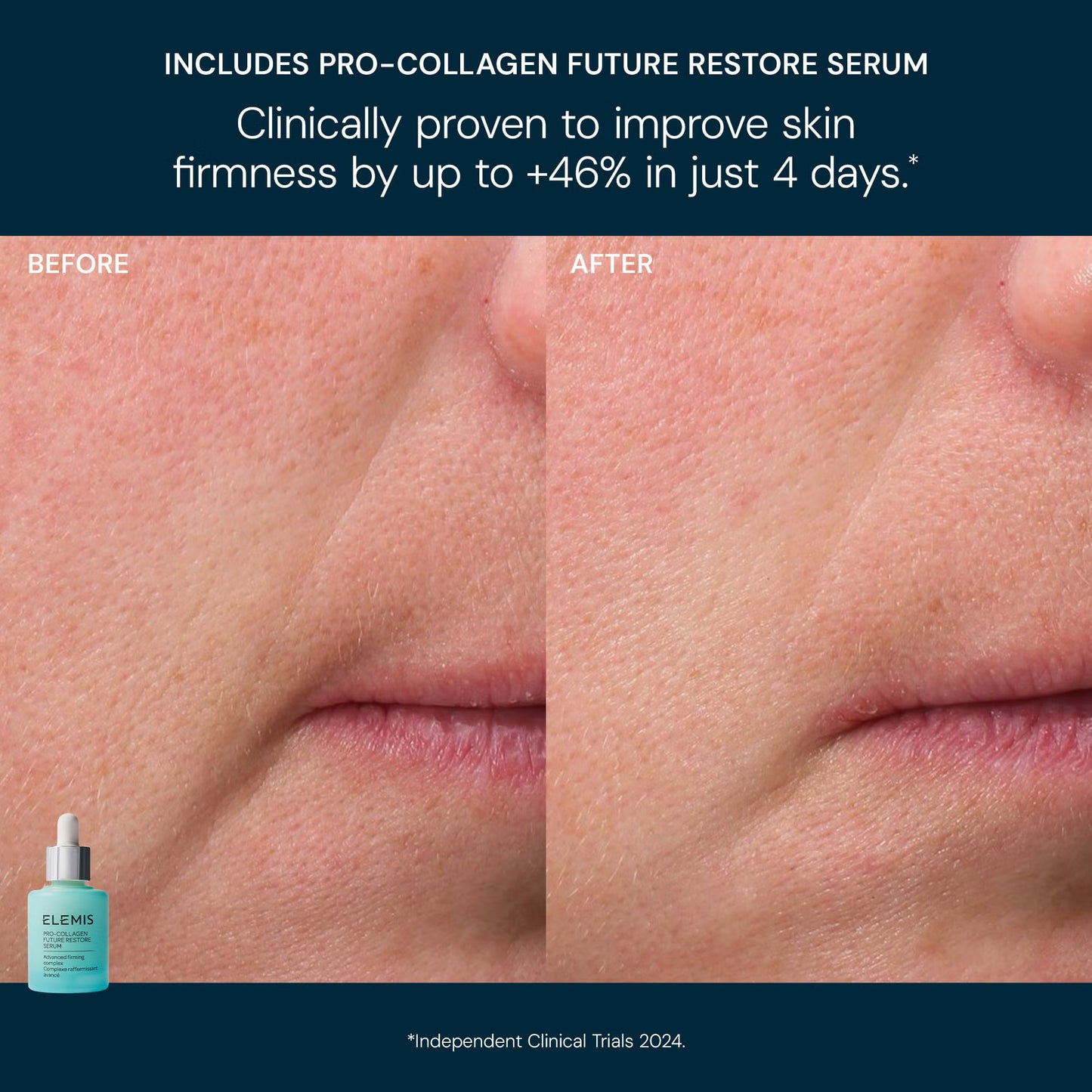 Elemis The Magic of Pro-Collagen Bundle