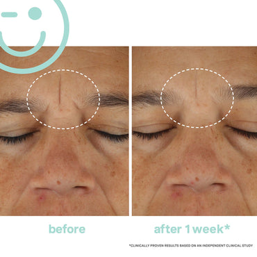 Kate Somerville Hydrakate Recharging Water Cream 50ml