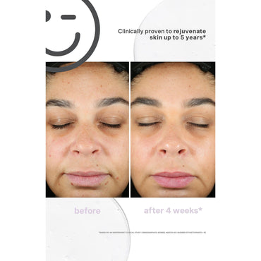 Kate Somerville KateCeuticals SuperCell Rejuvenation Serum 30ml