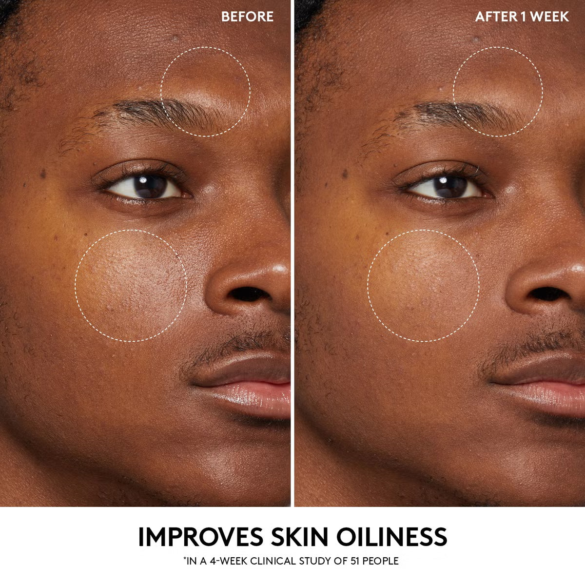 Fenty Skin Cherry Dub Pore Purify’R Gel Cleanser