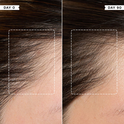 Philip Kingsley Density Preserving Scalp Drops
