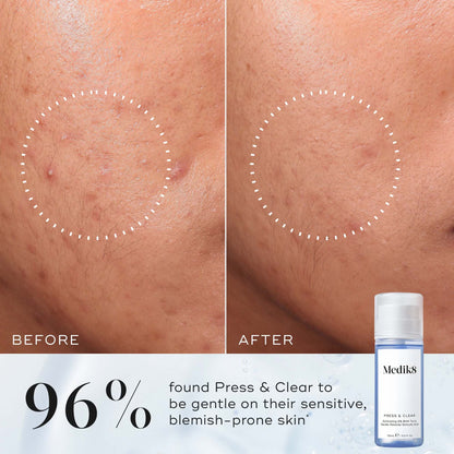 Medik8 Press and Clear Toner 150ml