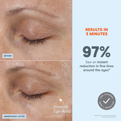 NuFACE FIX Microwand